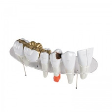 Model de anatomie mărită Erler-Zimmer 10x pentru morfologie dentară