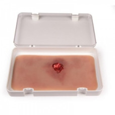 Erler Zimmer Wound Moulage Fractură deschisă Os braț cu funcție de sângerare
