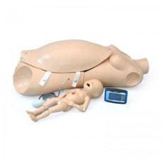 Tors de naștere maternă și neonatală